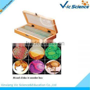 Clinical human blood disease prepared microscope slides