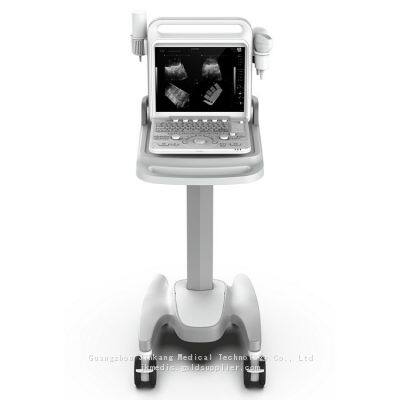 C20 Color Ultrasound Machine, Color Doppler photo-3