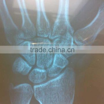 medical x-ray film, x ray film,CT/MRI/DR/ film