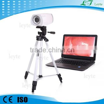 LTY9800 used video colposcope supplier Electronic colposcope prices