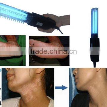 2016 Made in China: Portable Uvb Vitiligo Treatment Lamp, Anti-vitiligo Treatment photo-4