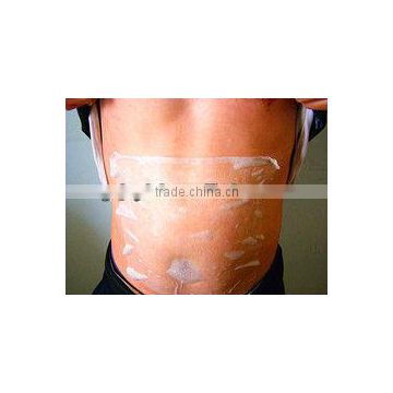 Beauty supplies cryolipolysis antifreeze membrane