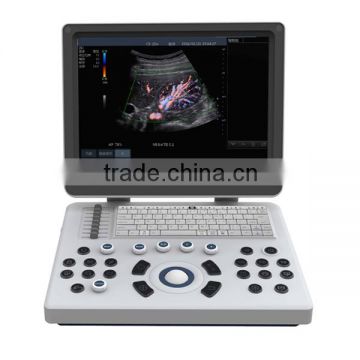 15inch Display 3 Transducer Ports Ultrasound Machine 3D 4D