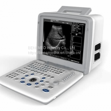 Portable B/W Ultrasound Scanner with Clear Image Quality