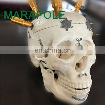 Surgical Orthopedic Maxillofacial Metallic Cranial Titanium Plate and Screw photo-6