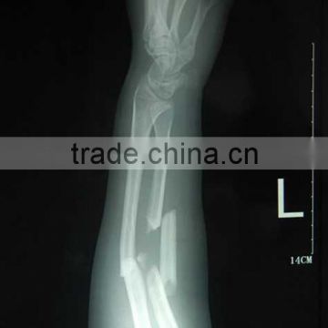 fuji medical x-ray film made in china alibaba, digital x ray film