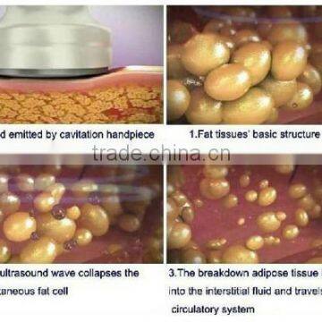 2015 Cavitation Ultrasonic Liposuction RF Vacuum Therapy Machine photo-5