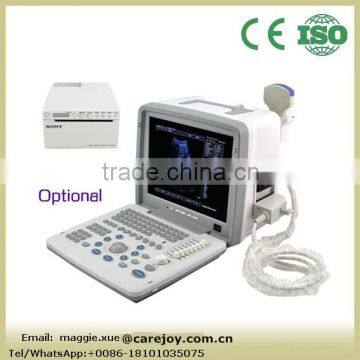 Portable Ultrasound Scanner with 3.5Mhz probe optional video thermal recorder linear probe transvaginal