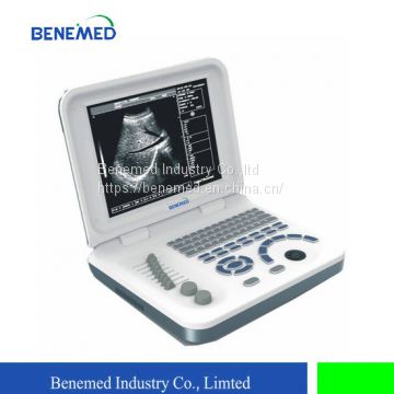 Notebook B/W Ultrasound Scanner BW-6