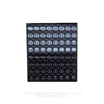 Digital X-ray Films，Dry Films, Thermal Films for Digital X-ray photo-4