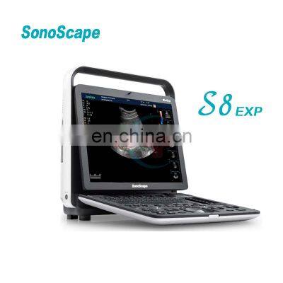 Top sale Ultrasound machine /Color doppler ultrasound /Sonoscape s8 exp laptop color doppler ultrasound