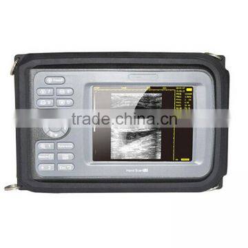 High Quality CE Approved Pocket Ultrasound Machine Hand-held Ultrasound Scanner photo-2