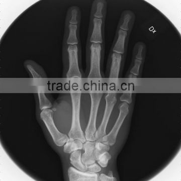 agfa x-ray film 14x17, medical x-ray film agfa from zhejiang hangzhou