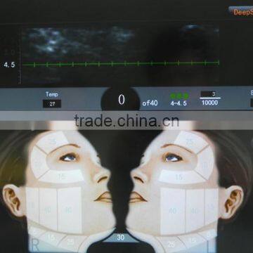 2016 CE Approval Transducer HIFU Face Lift Beauty Machine photo-6