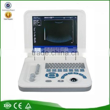 Hot Cheapest Large Screen 10.4 inch Laptop Ultrasound Scanner Machine with Probe--RUS-9000F2