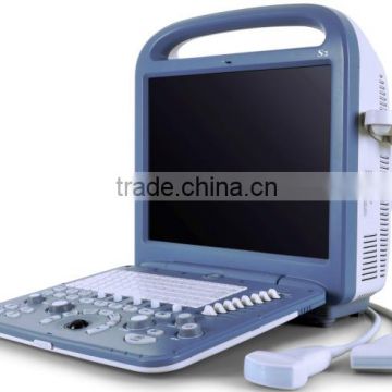 Sonoscape S2 portable ultrasound machine low cost portable ultrasound machine