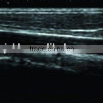 CE Hot Sale Portable Laptop Ultrasound Scanner/Machine Hospital Clinic Diagnosis With Probe/Transducer and Printer photo-4