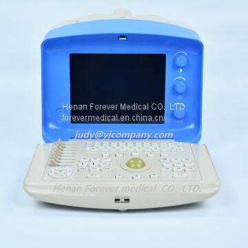 Trolley Color Doppler Ultrasound Scanner System (YJ-U300t) photo-5