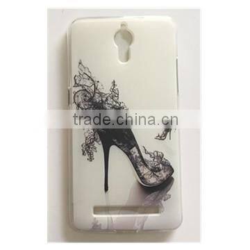 Printed TPU Cell Suit for iPhone