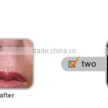 Promotion Best Professional Homeuse Acne Scar Laser Treatment Device photo-6