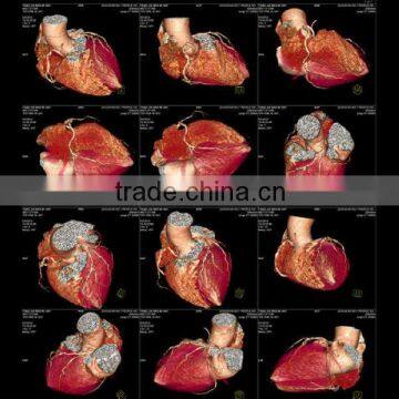 Laser x-ray film