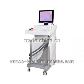 Germany Xenon lamp IPL laser device