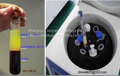 Compact Lab Centrfiuge PRP Kit Brushless Motor PRP/Syringe Dental LC-400 photo-4