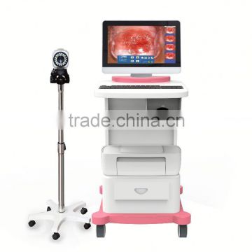 Portable vagina colposcope camara FOR CE