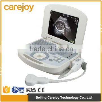 Positive feedbacks high-quality image 10.4 inch screen good portable ultrasound machine price