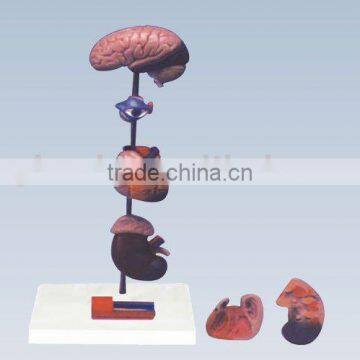 QH3333-4 Hypertension model