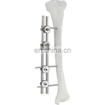 Guaranteed Quality Femur & Tibia External Fixator Surgical Implant