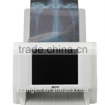 Medical x-ray film digitizer