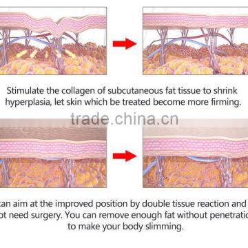 Nasolabial Folds Removal The Hifu High Intensity Focused 1.0-10mm Ultrasound Machine For Body Slimming High Frequency Portable Facial Machine