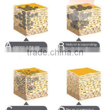 Tattoo Removal Ota Neves Laser HS-250E photo-4