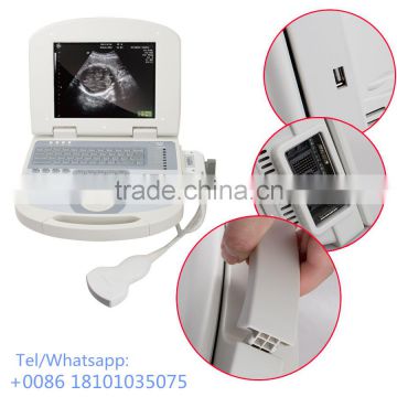 CE approved portable ultrasound scanner 96 element USG ultrasonography diagnosis Machine