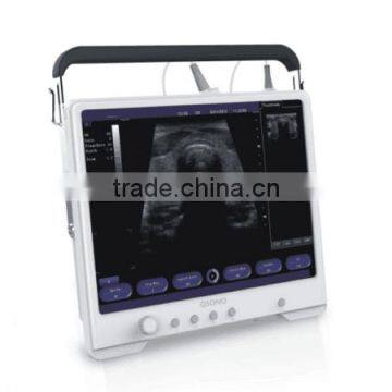 Handheld ultrasound scanne & B/W Ultrasound Machine