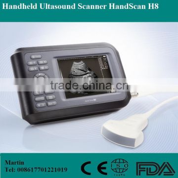 portable handheld ultrasound scanner