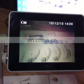MY-G054C Video Laryngoscope Price Video Laryngoscope Portable Flexible Laryngoscope photo-3