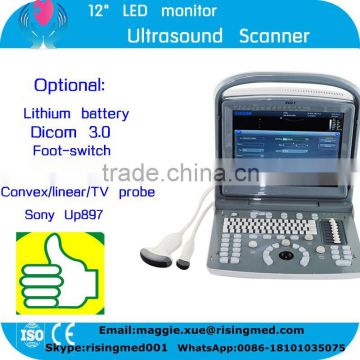 CE ISO FDA approved Chison brand Ultrasound Scanner with 2.5-5.0MHz Convex probe Foot switch Sony UP897 optional