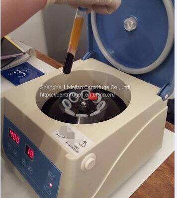 Compact Lab Centrfiuge PRP Kit Brushless Motor PRP/Syringe Dental LC-400 photo-5