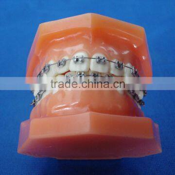 orthodontic teeth model/dental orthodontic models