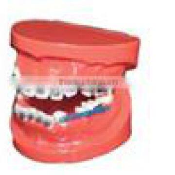 Human Dental Teaching Models Newly dental orthodontic treatment model for teeth study AC-P17