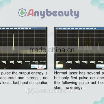 Anybeauty Hot Sale 532nm&1064nm for All Tattoo Removal Beauty Machine
