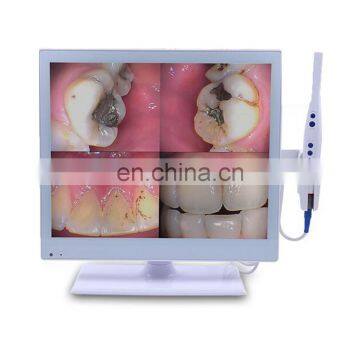 MY-M067-1 intra oral camera medical dental equipment wifi wireless intraoral camera dental