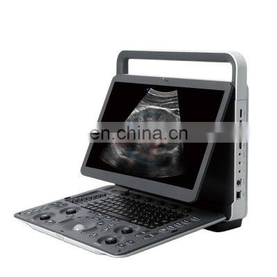 Portable Laptop Sonoscape E2 Ultrasound Machine Color Doppler Ultrasound Device System