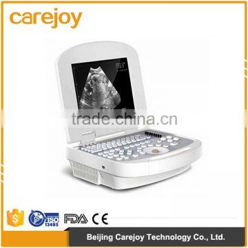 China beijing 10.7 inch color LCD 2B Ultrasound Imaging System laptop ultrasound scanner with CE ISO Approved