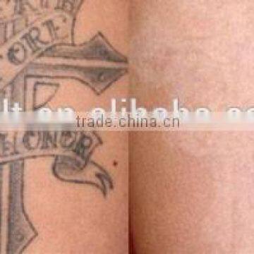 Merry Christmas! Professional Home Use Laser Pigment nd Yag Machine for Q7 photo-6