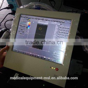 Coupon Available! Ipad Ultrasound Scanner, Touch Screen Scanner 3D Color Doppler MSLCU22-N