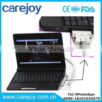 Carejoy CE approved Laptop Ultrasound Scanner/machine with Convex, Linear Probe/Transducers and Sony Printer