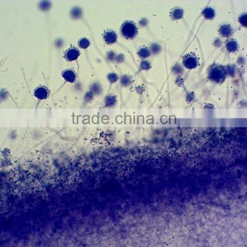 medical bacteria prepared microbiology slides/prepared microscope slides